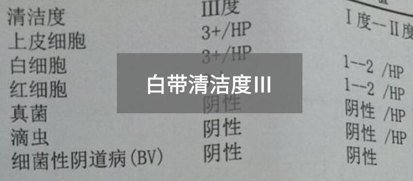 今天快讯！全自动白带在线观看香蕉视频生产厂家911香蕉视频APP为您官方解释白带清洁度3的意思